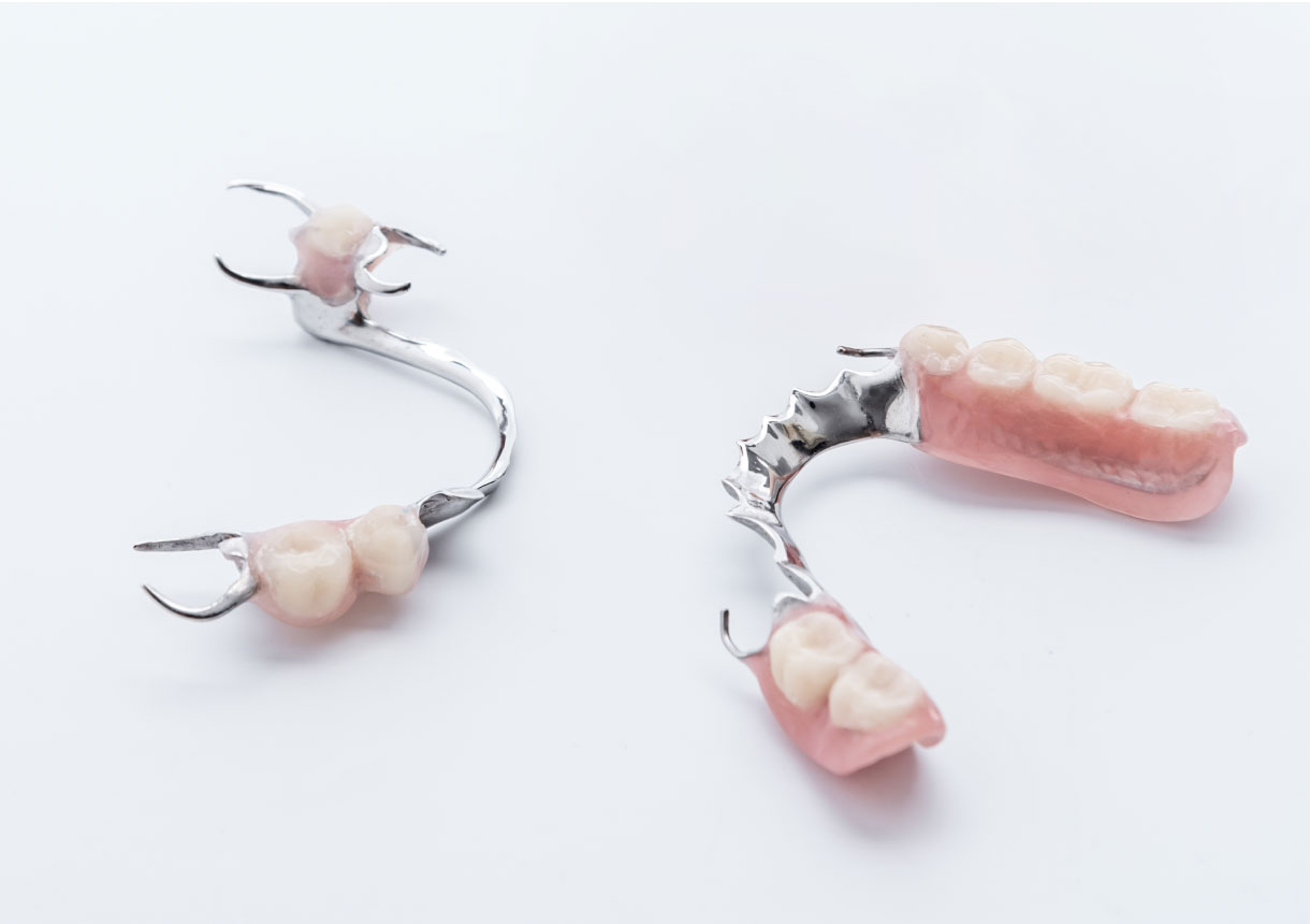 総入れ歯（全部床義歯）