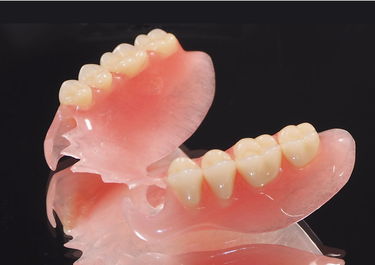 ノンクラスプデンチャー