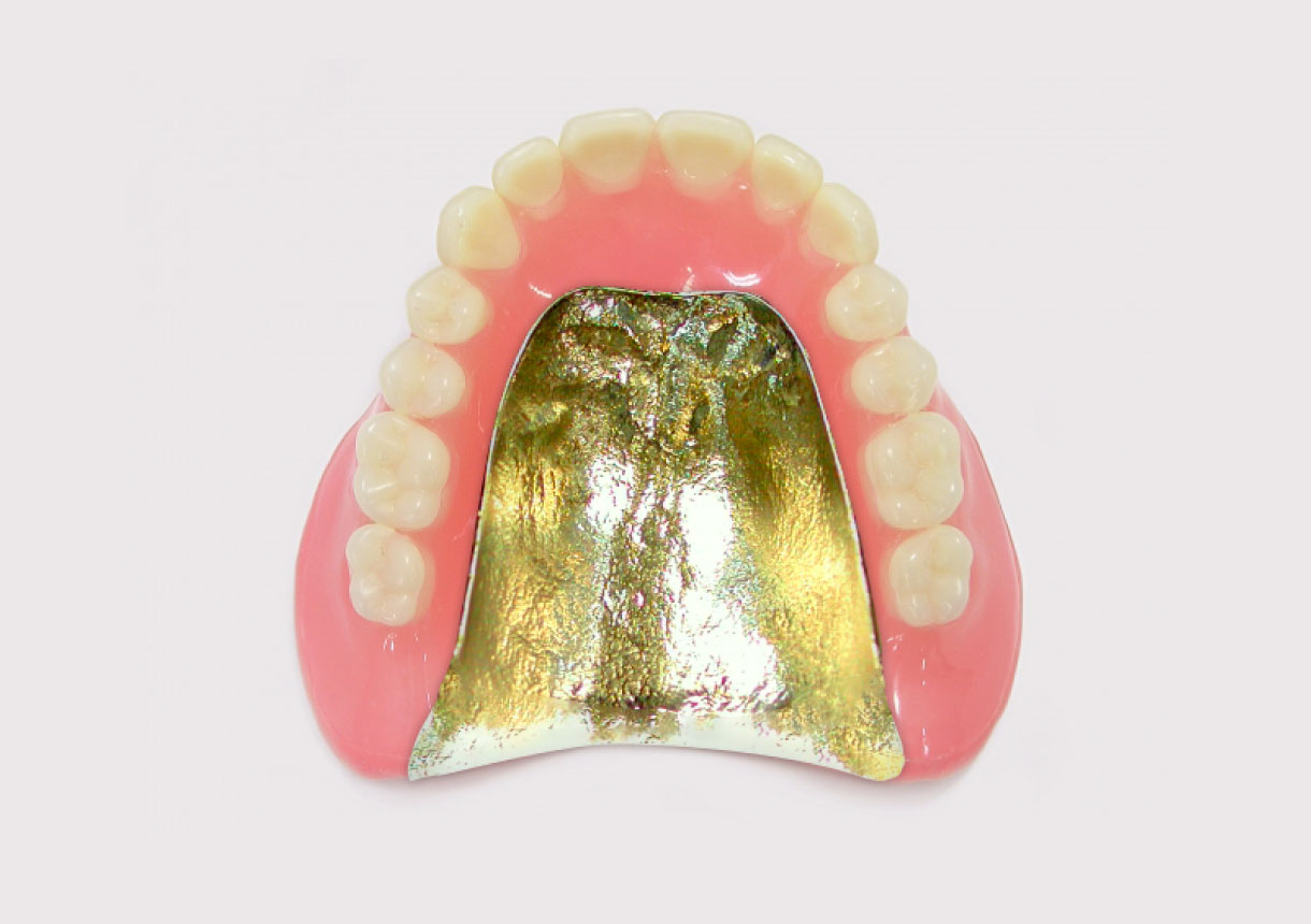金属床義歯（ゴールド）