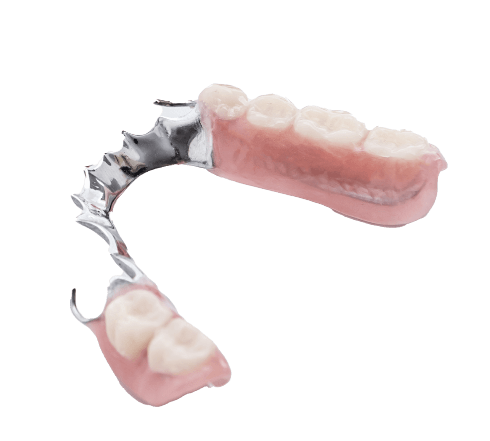 総入れ歯（全部床義歯）