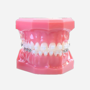 二期治療(12歳頃から開始)